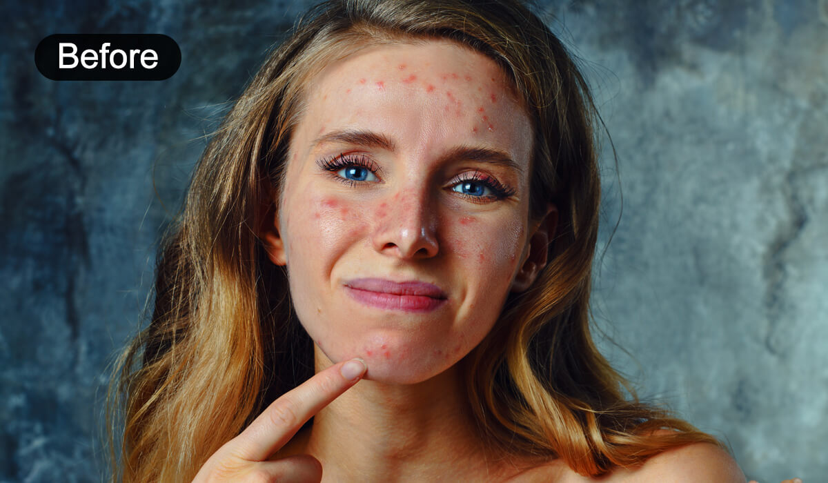 More Than Just Eye Bag Removal