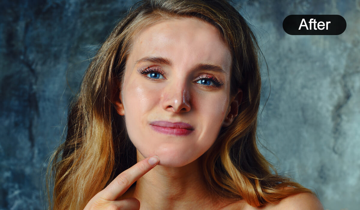 More Than Just Eye Bag Removal