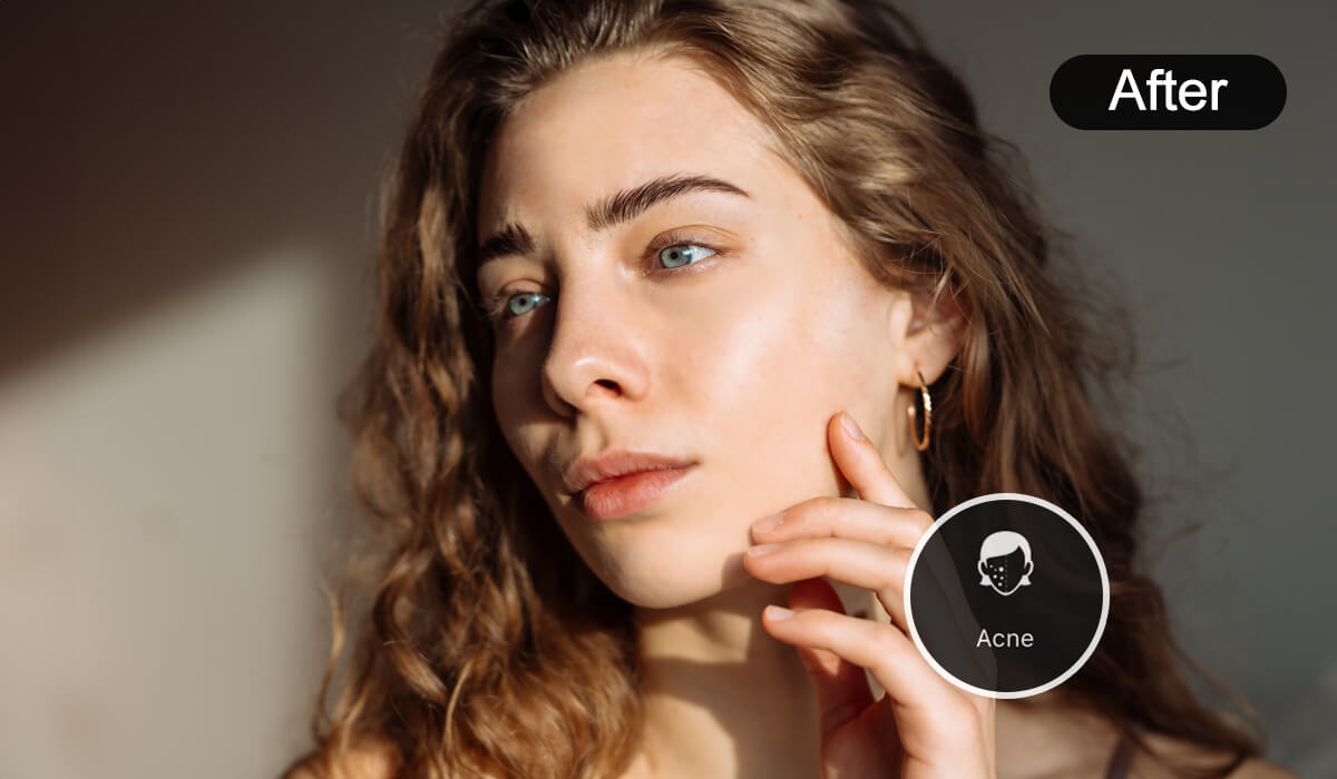 Auto Detection to Remove Acne From Photo