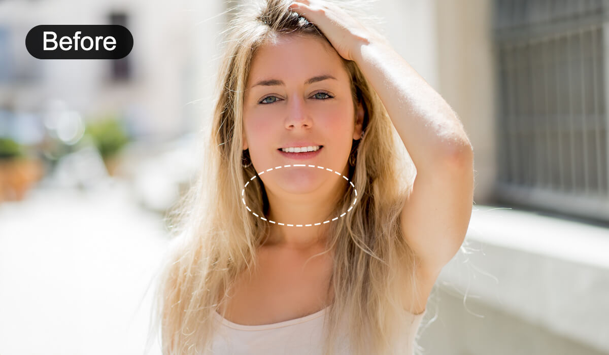 One Tap Double Chin Removal