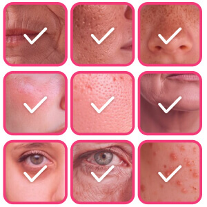 Choose Skin Concerns