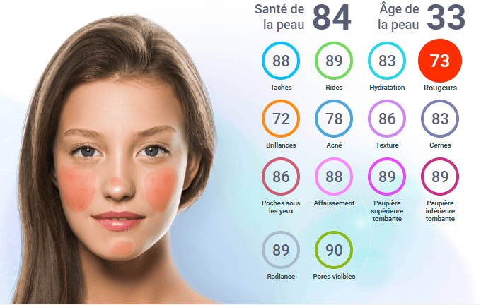 diagnostic de peau en IA