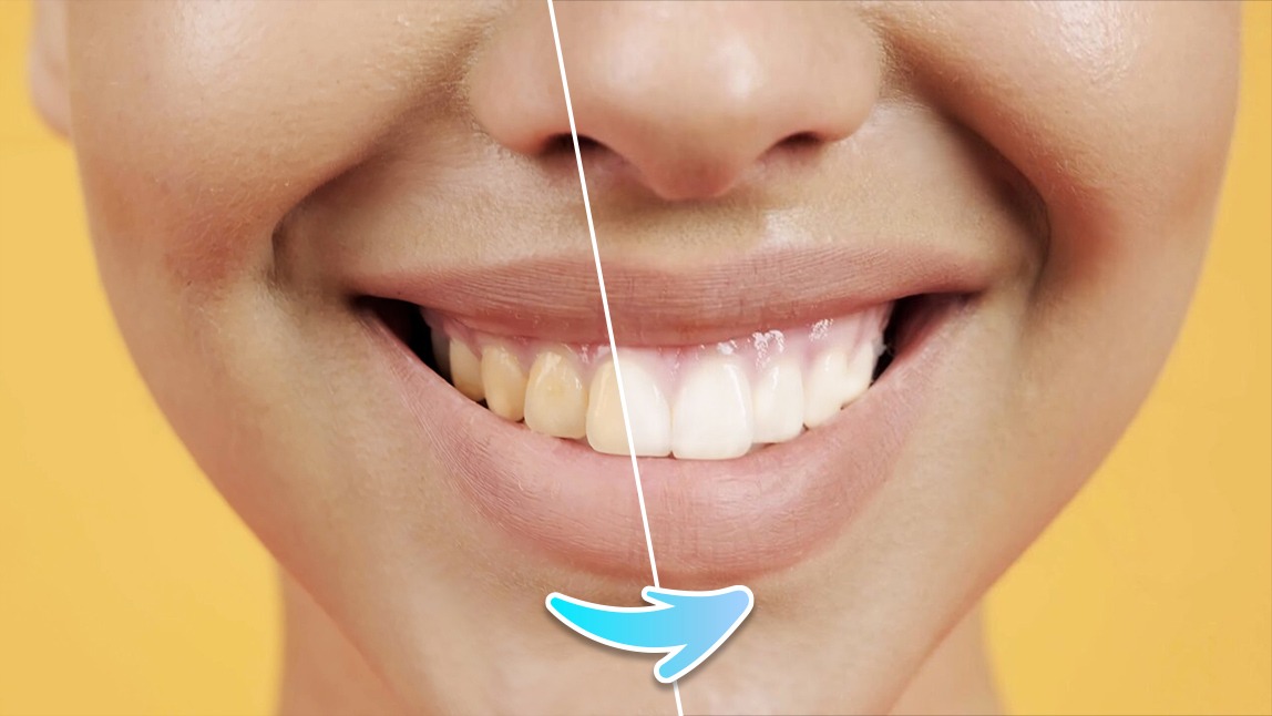 How to Whiten Teeth in Video With a Video Filter App PERFECT
