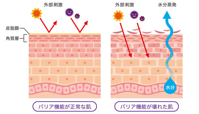 肌のバリア機能が低下する様子