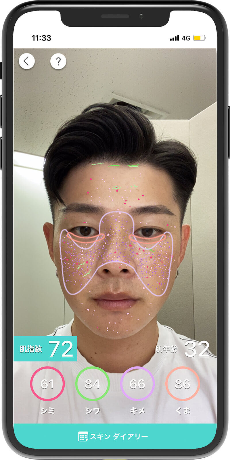 肌診断する様子