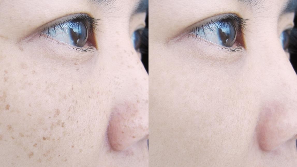 他にどうすれば痰を早く取り除くことができますか?