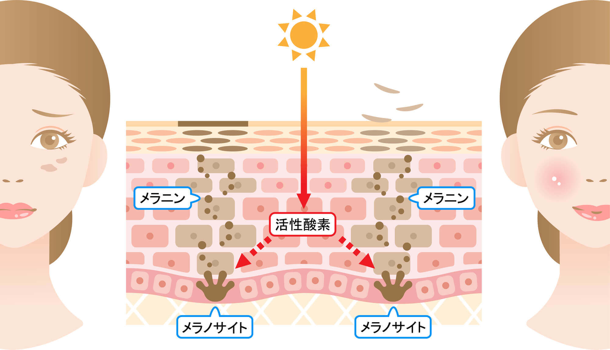シミができるメカニズム