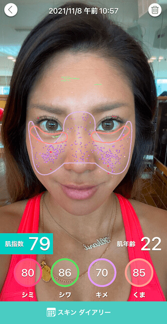 肌診断をする様子