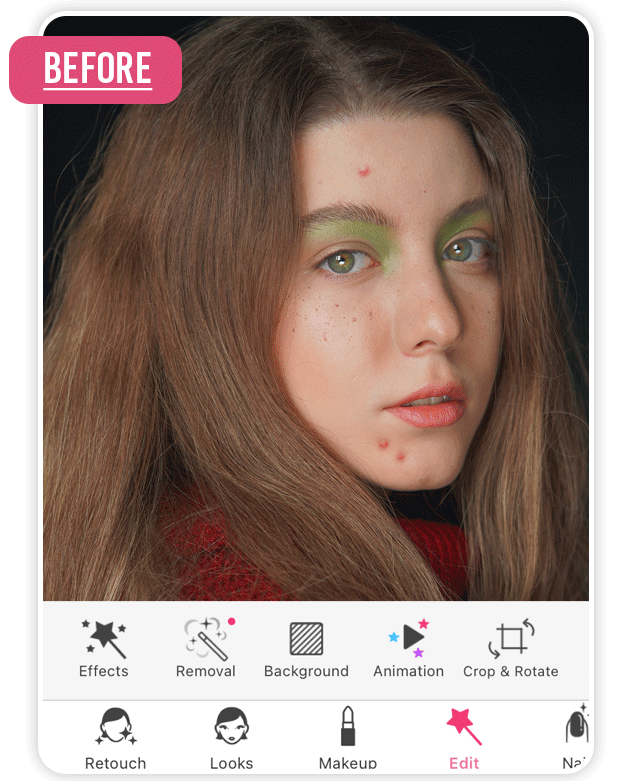 eliminar imperfecciones del rostro como acne