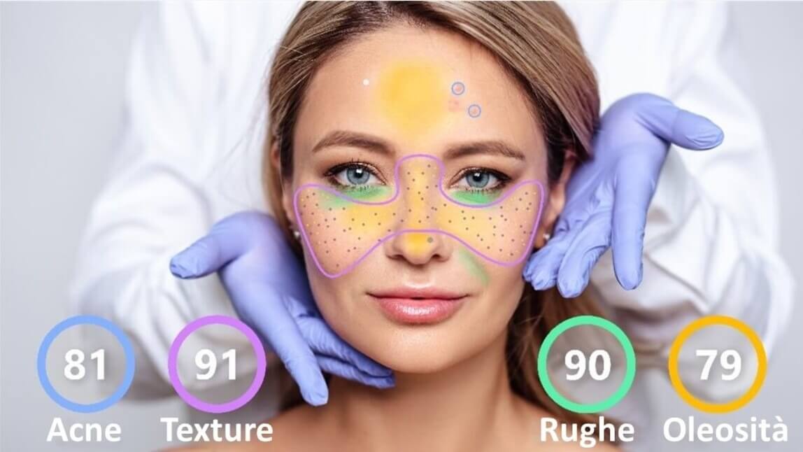 Skin Scanner per Rilevazione Acne: i Modelli Più Diffusi