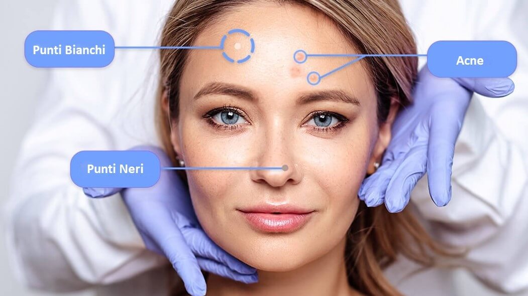 Lo skin scanner di Perfect Corp. è specializzato nella rilevazione dell'acne.