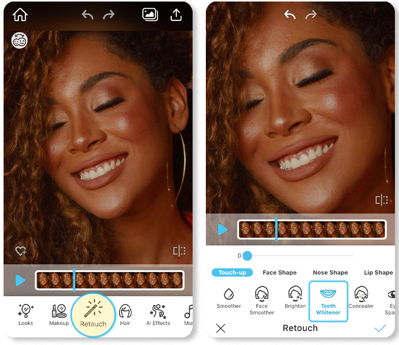 Try Lip Fillers Before and After With a Video Filter App PERFECT