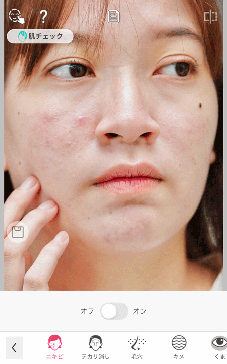 アプリでニキビを消す様子