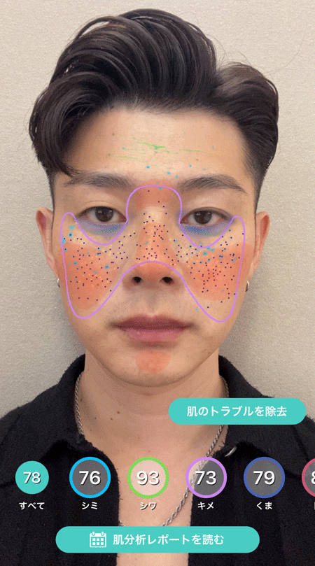 AIが肌の状態からイケメン度を診断