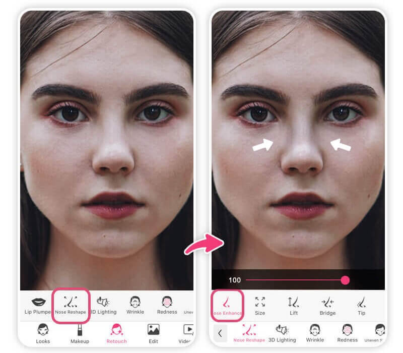 simulador de rinoplastia virtual
