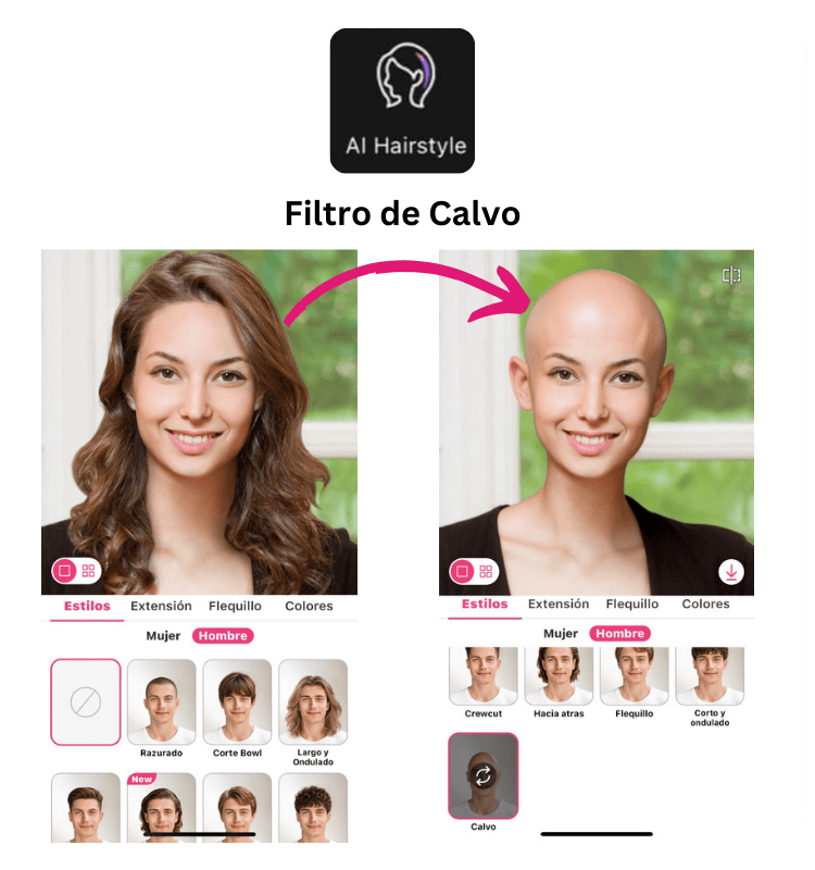 filtro de calvo