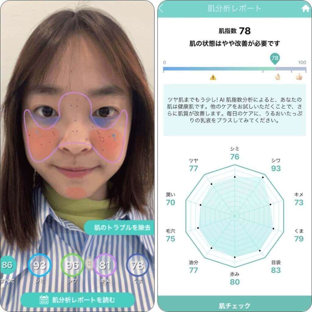 スマホアプリで乾燥肌か脂性肌かを診断
