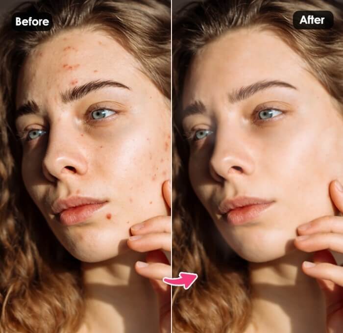 Supprimer imperfection des photos