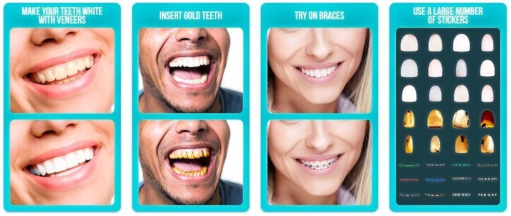 See what would I look like with perfect teeth using virtual teeth makeover app