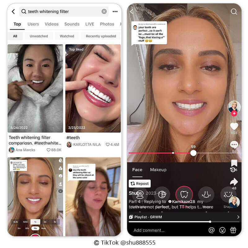 See what would i look like with veneers using perfect teeth filter