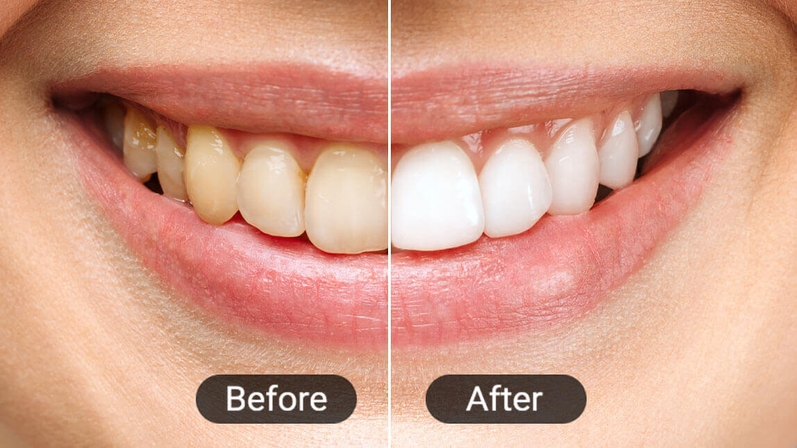 What would I look like with perfect teeth
