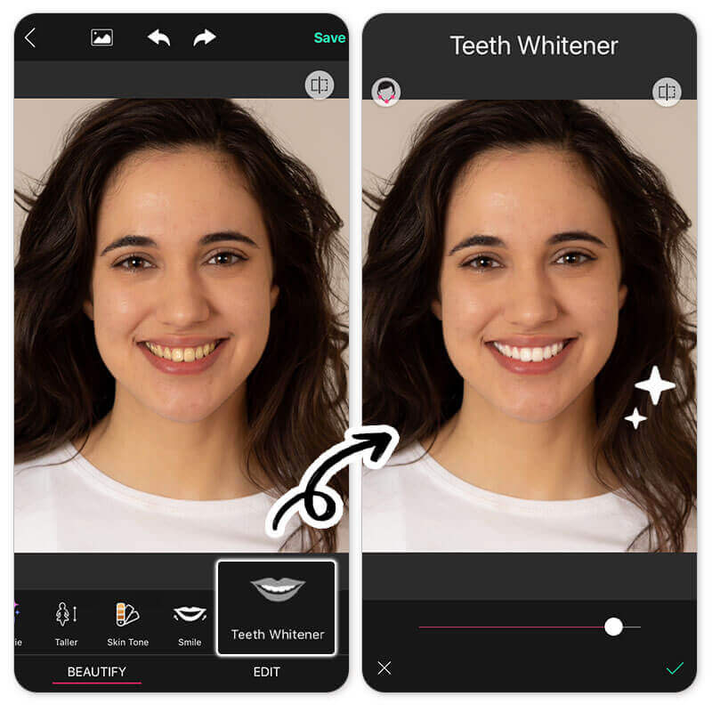 Veneer App: What would i look like with veneers