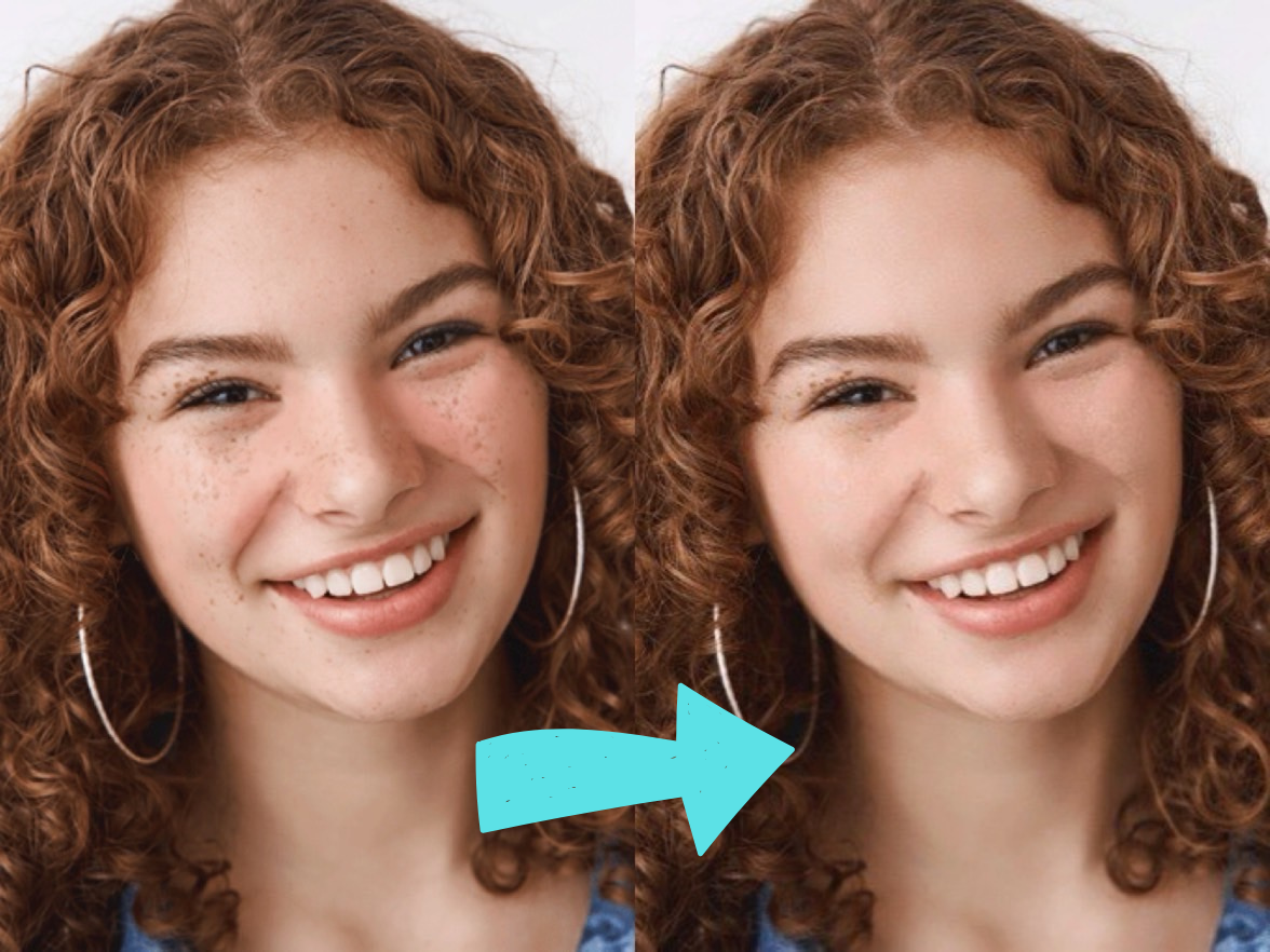 Remove Freckles and Moles From Your Face Online Using YouCam Online Editor for Free