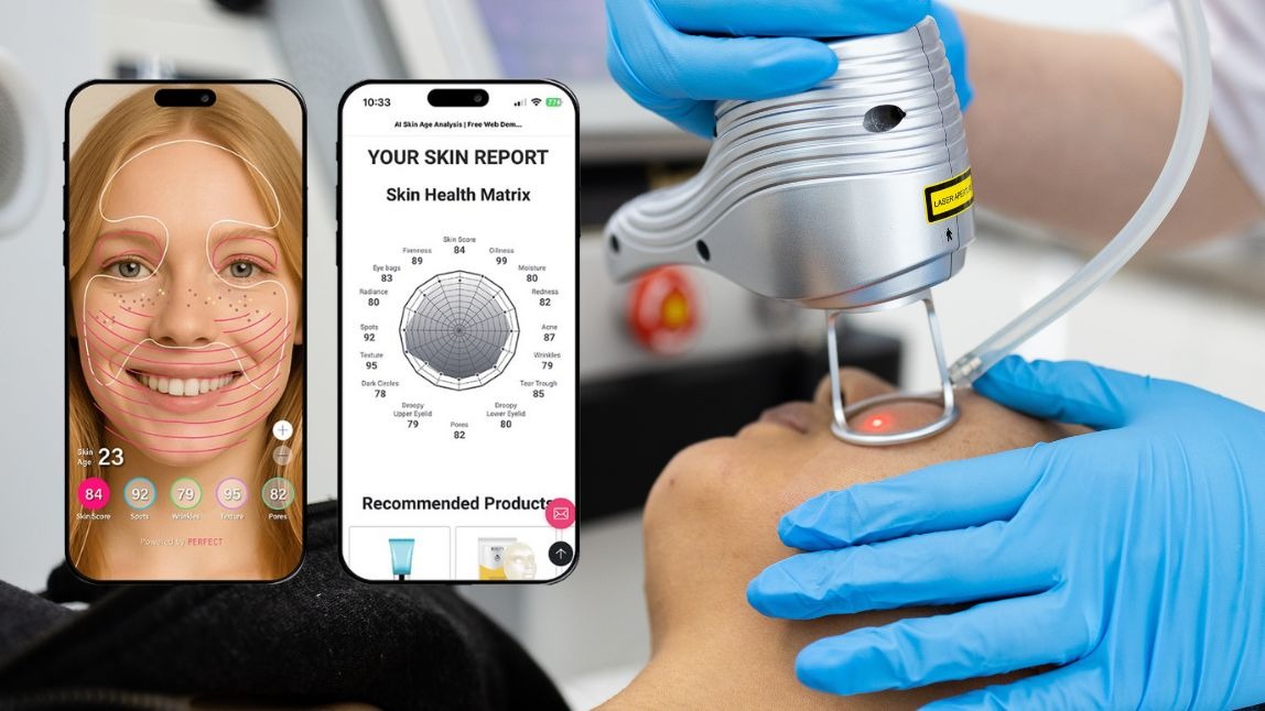 laser skin resurfacing