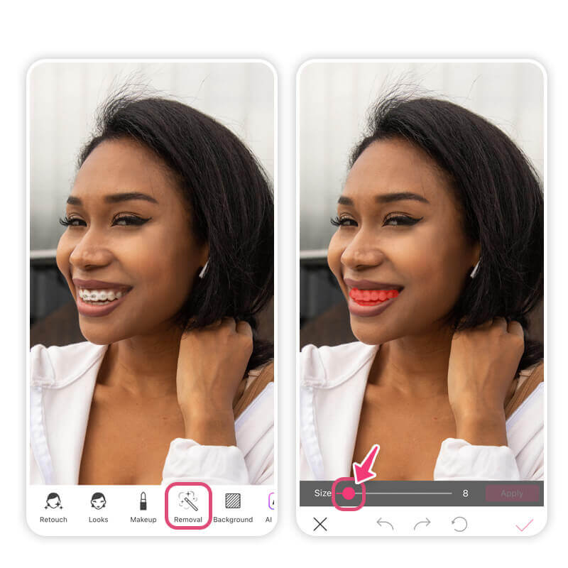 Remove braces or teeth retainer from your photo before and after