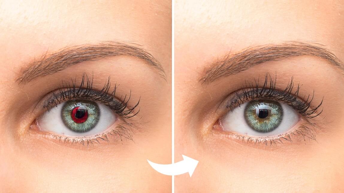 Corriger les yeux rouges sur photo
