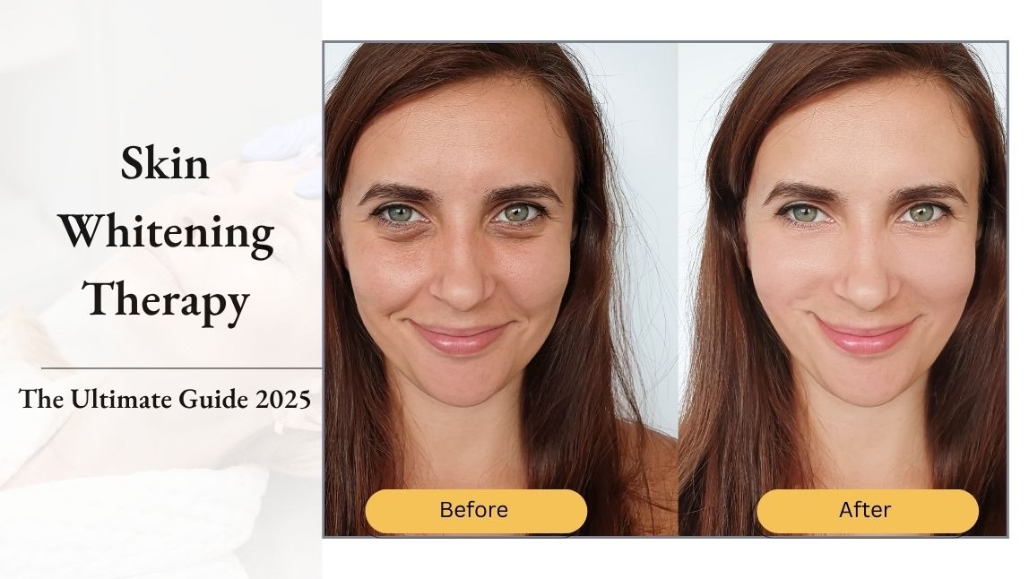 Skin Whitening Therapy: Guide, Treatments & Expert Tips [2025]