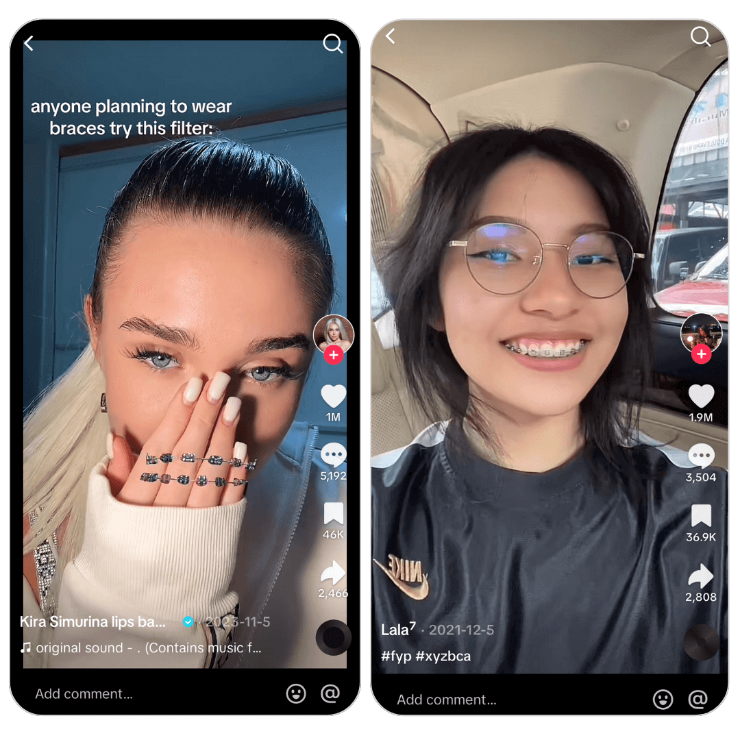 Câmera com filtro de aparelho para ver como eu ficaria com aparelho