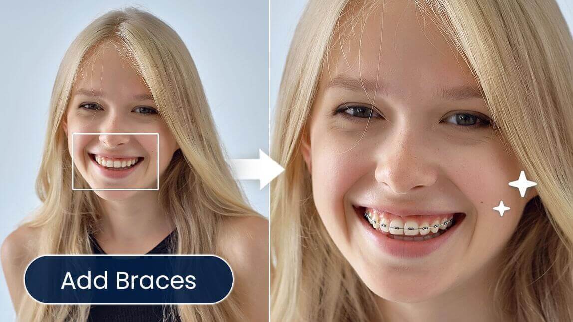 Antes e depois de uma garota usando um simulador para testar o filtro de aparelho nos dentes e ver como ficaria com um sorriso de aparelho.