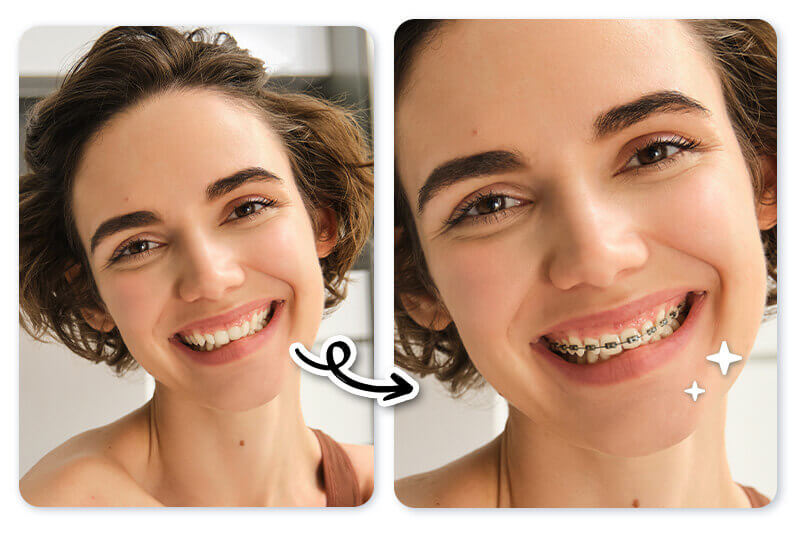 Mulher testando como ficaria com aparelho usando um filtro de aparelho dentário