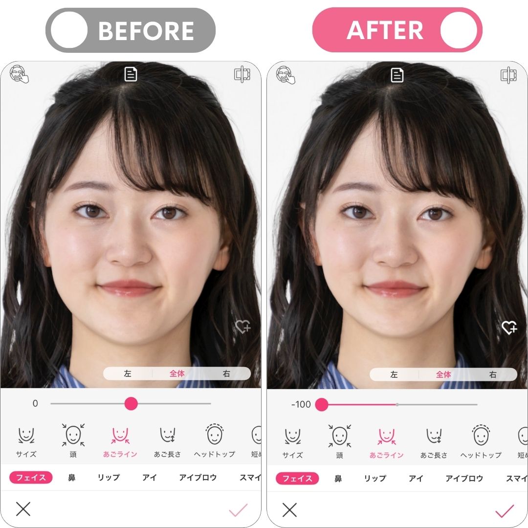 輪郭まわりの整形シミュレーション