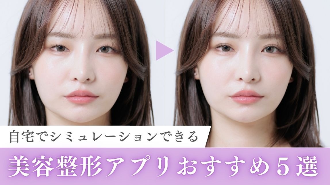 【無料】どこを整形すればいいかシミュレーションできるアプリおすすめ５選！使い方も紹介【2025年最新】
