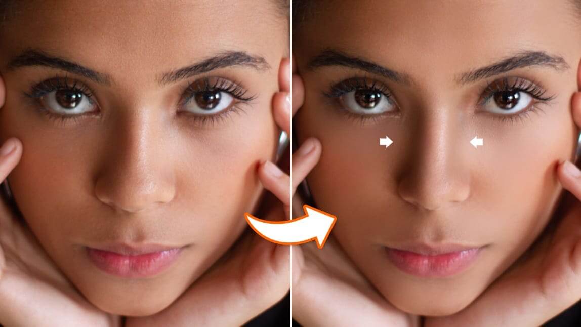 Antes e depois do rosto de uma mulher usando um simulador de rinoplastia para afinar a ponte e diminuir o nariz na foto.