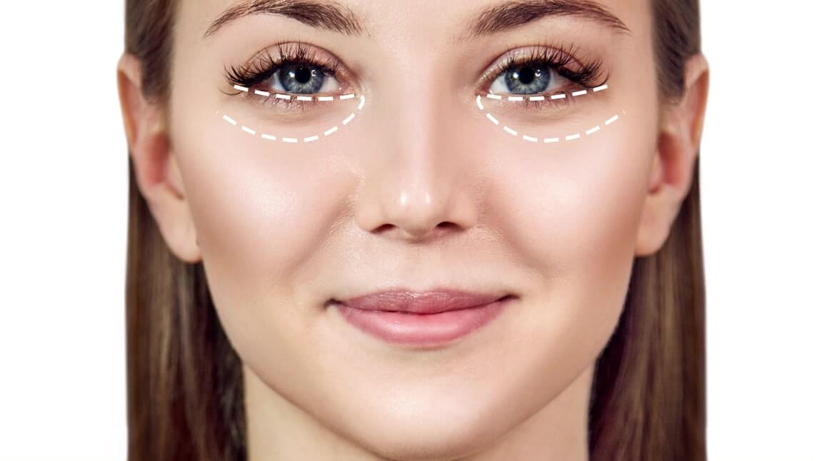 Mulher usando aplicativo para tirar olheiras da foto com o app YouCam Makeup.