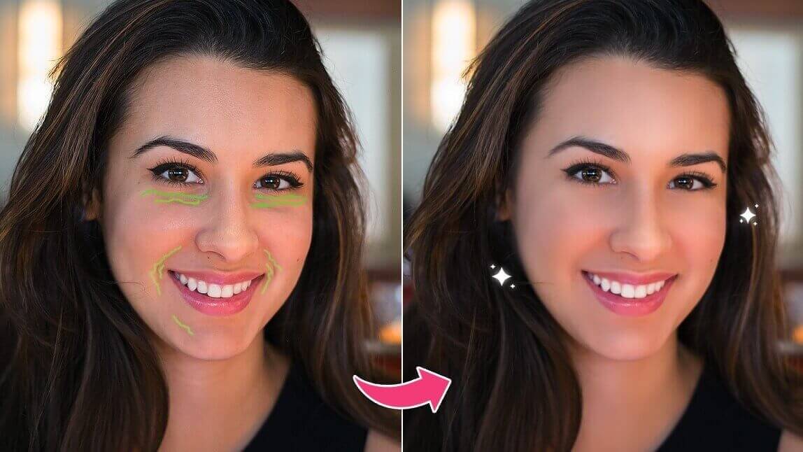 Antes e depois de uma mulher usando um aplicativo para tirar rugas de fotos, mostrando a remoção de linhas de expressão ao redor dos olhos e boca.