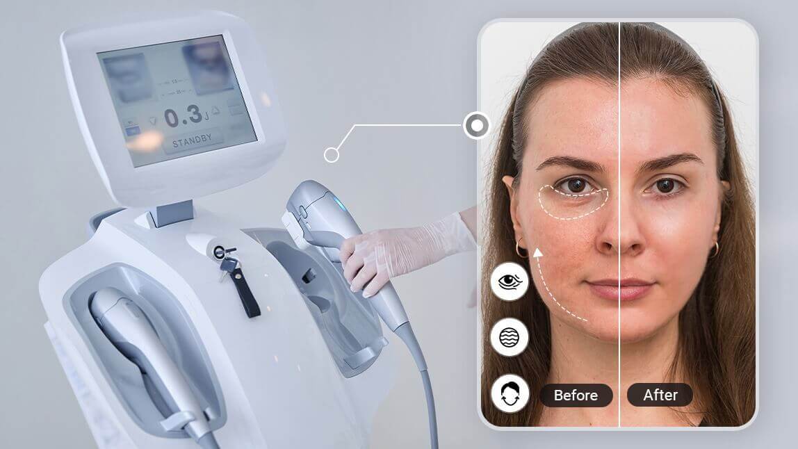Comparing 5 HIFU Machines: Features, Costs, and How AI Enhances Performance