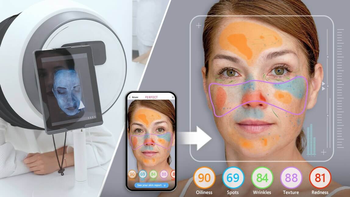skin analysis