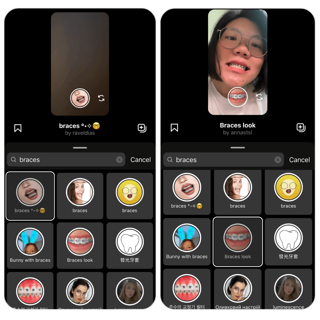 See how would I look with braces using braces simulator
