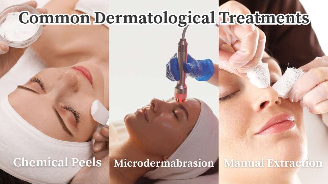 Common Treatments for Congested Skin