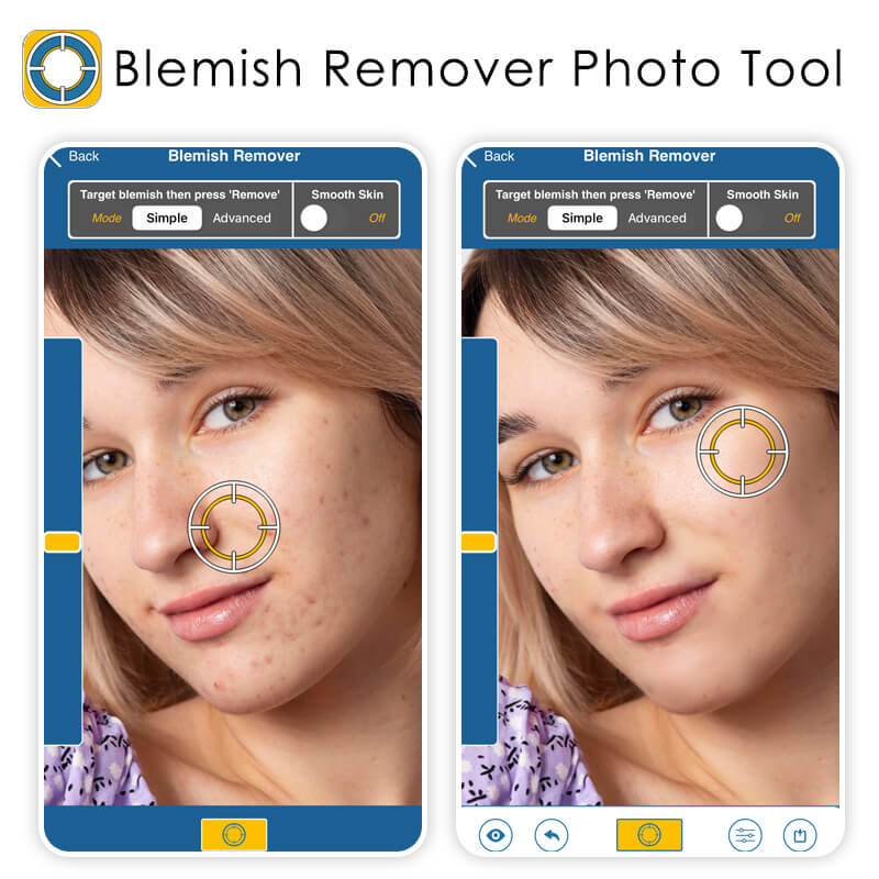 Best photo blemish remover app: Blemish Remover Photo Tool