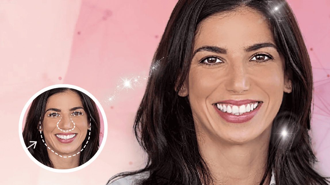 Simulador de bichectomía virtual mostrando antes y después en rostro femenino