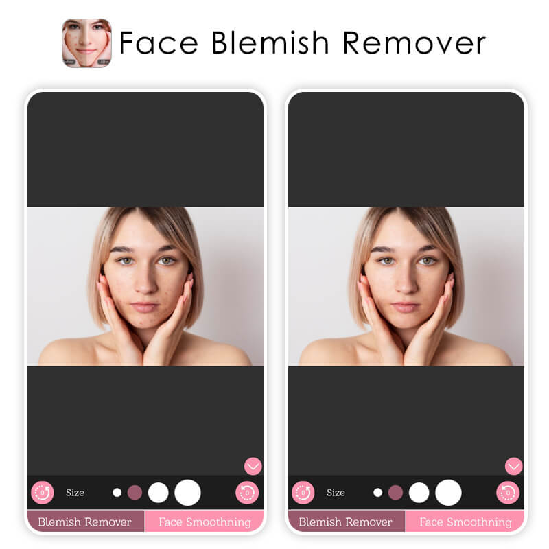 Best blemish remover app: Face Blemish Remover