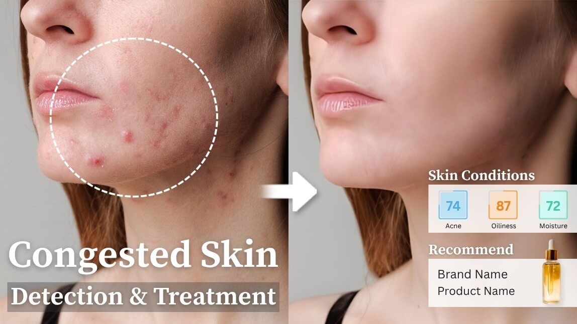 What is Congested Skin? Causes, Treatments, and AI Solutions