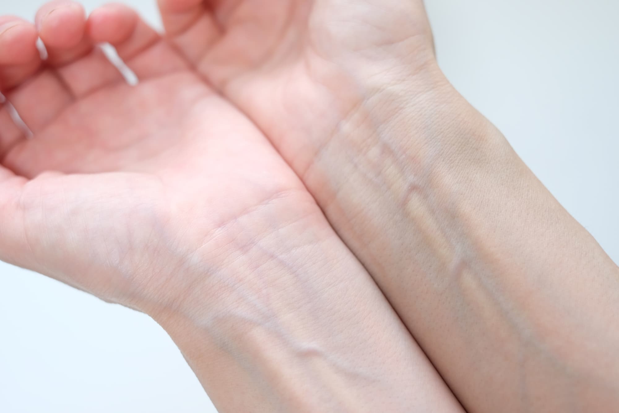質問③手首の内側にある血管の色は、何色に見えますか？
