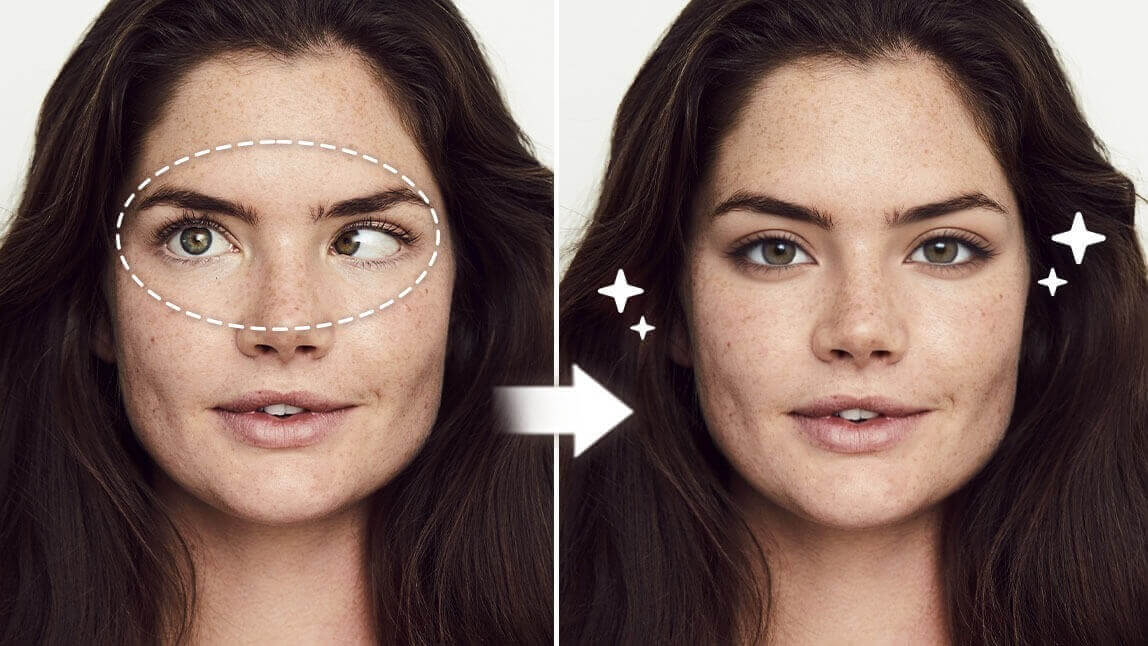 Antes e depois de usar um aplicativo para corrigir olho vesgo em foto, mostrando como arrumar um olho torto para obter um olhar perfeitamente alinhado.