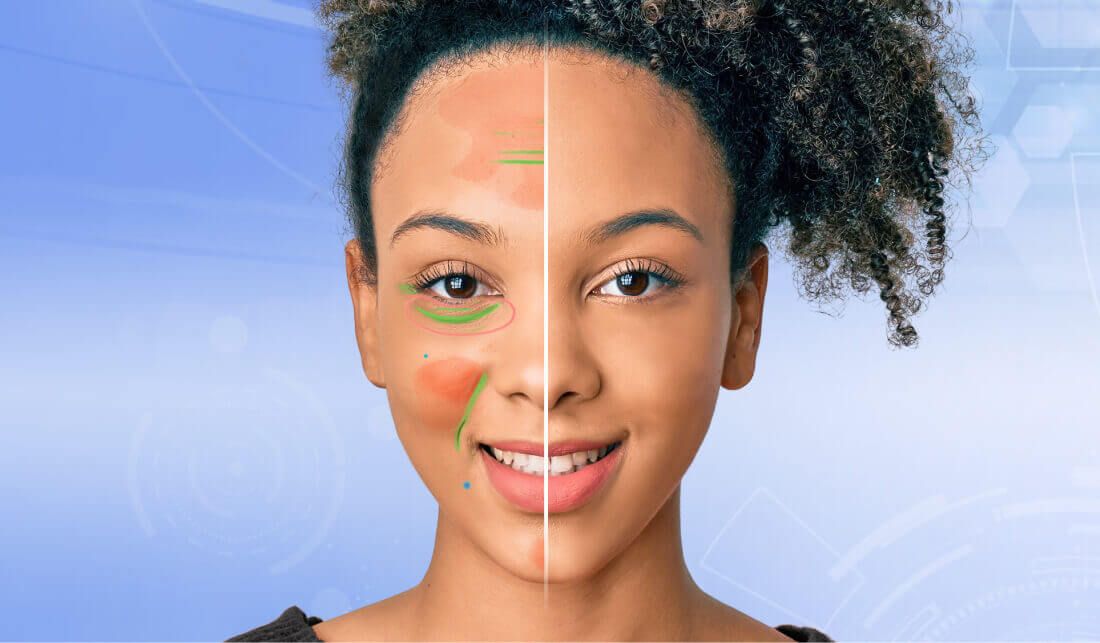 Persona realizándose un Análisis de Piel con Inteligencia Artificial en línea.  Persona realizándose un Análisis de Piel con Inteligencia Artificial en línea.